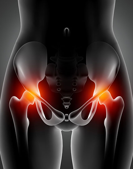 Hip & Musculoskeletal Pain